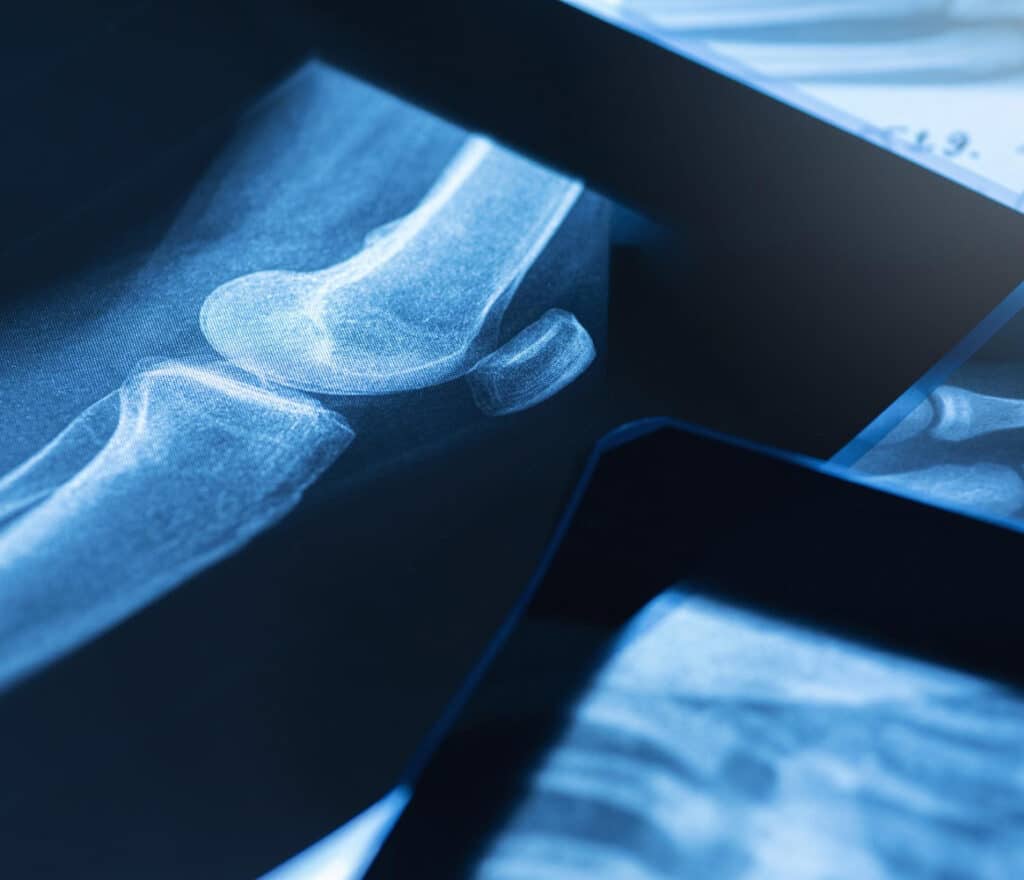 Regenerative Relief for Chronic & Acute Pain​