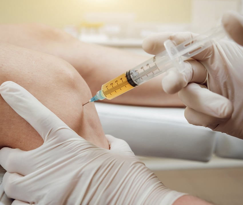 LOCAL INJECTIONS STEM CELLS